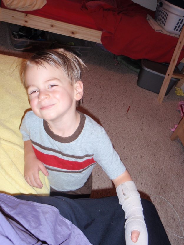 hand slammed in door