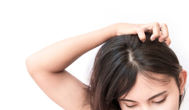 natural lice treatment natural lice treatment
