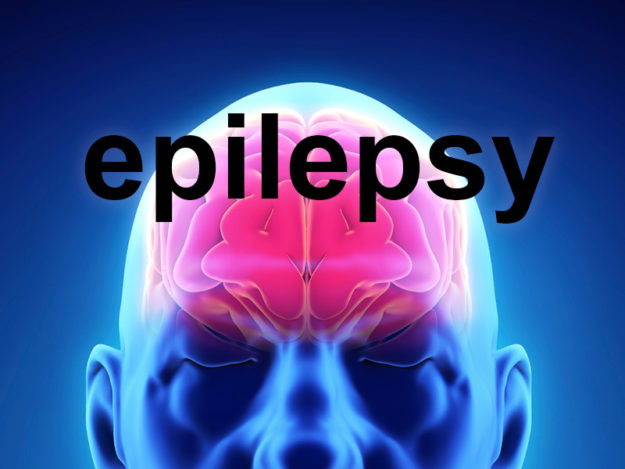 brain epilepsy seizures homeopathy brain epilepsy seizures homeopathy