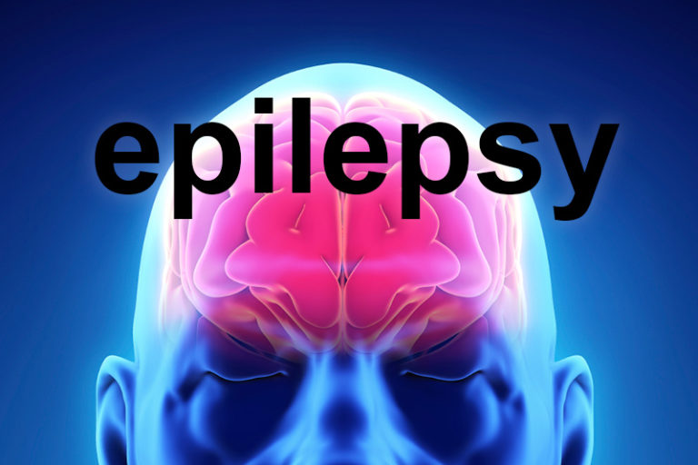 brain epilepsy seizures homeopathy brain epilepsy seizures homeopathy