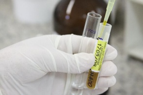 DiagnosingLeptospirosis