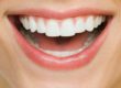 NaturalTreatmentCavities