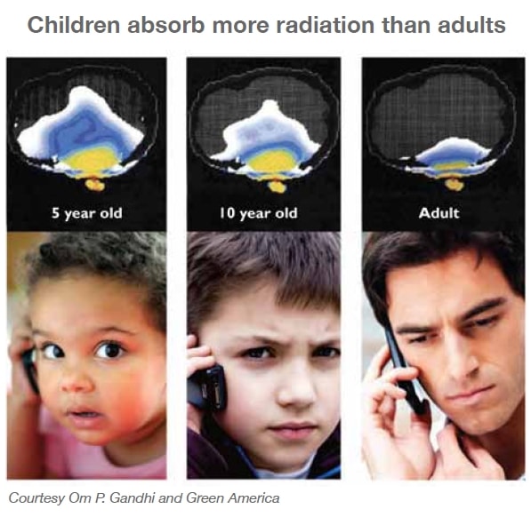 Children-brain-radiation children brain radiation